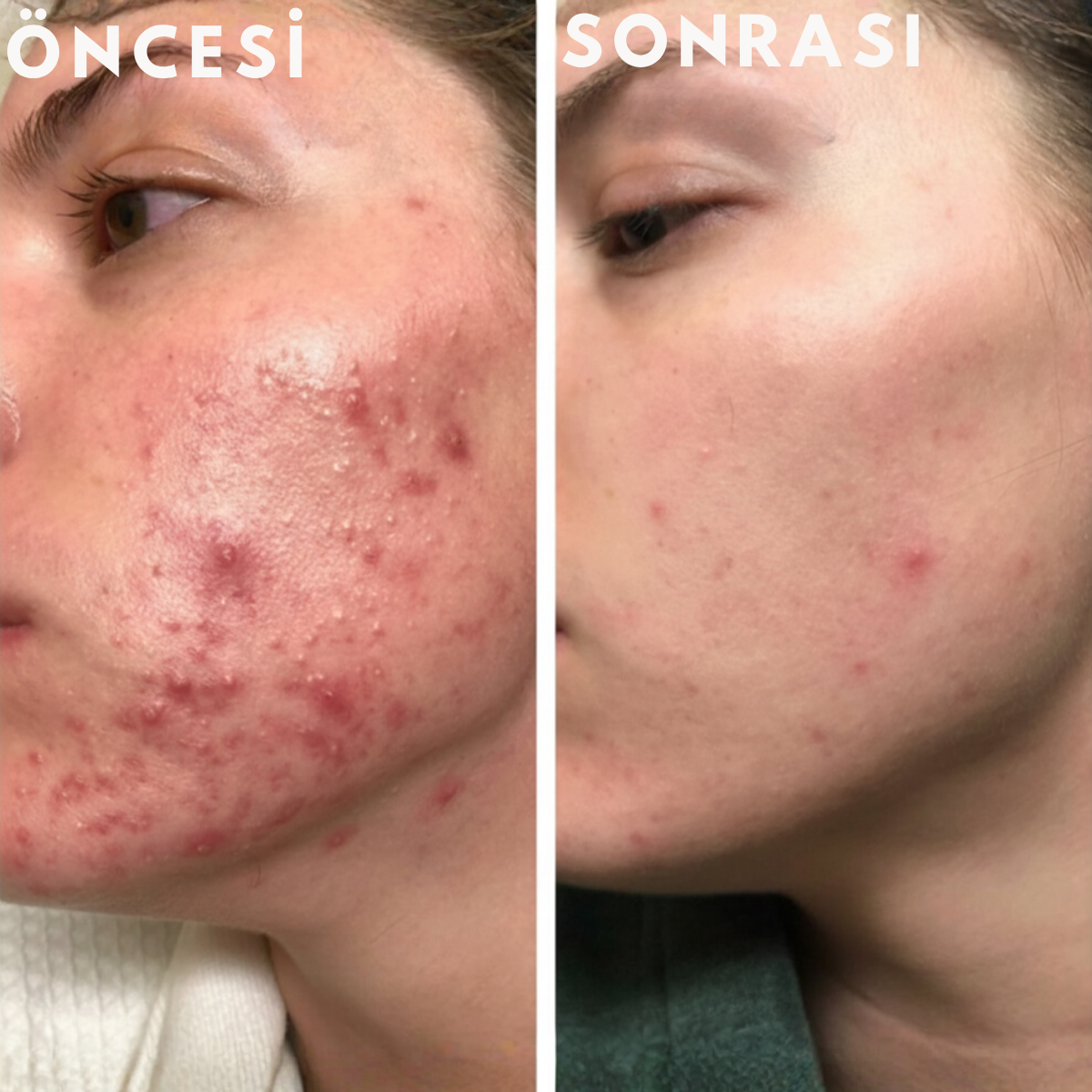 Glowin Gelişmiş Yüz Fırçası